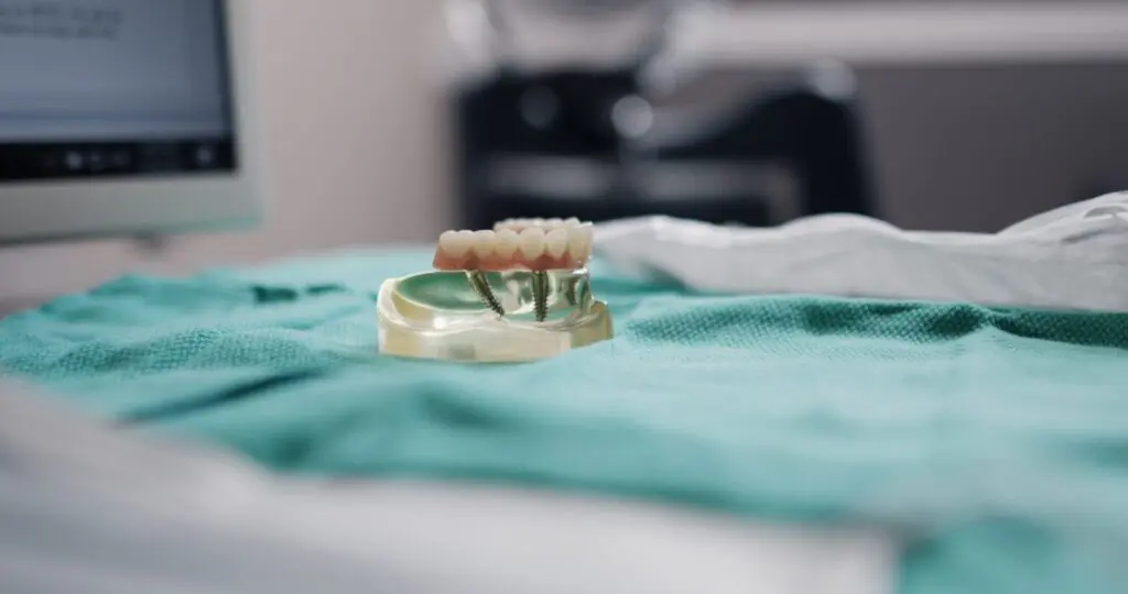 All on 4 model lower jaw