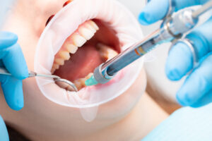 exeter dental sedation